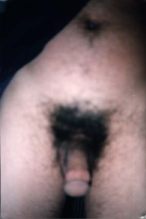 Sexe masculin.